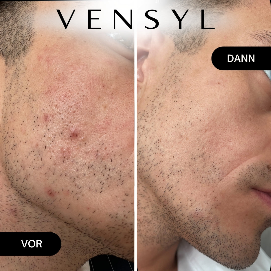 Vensyl Anti-aging Basis-Gesichtspflegepaket für Männer